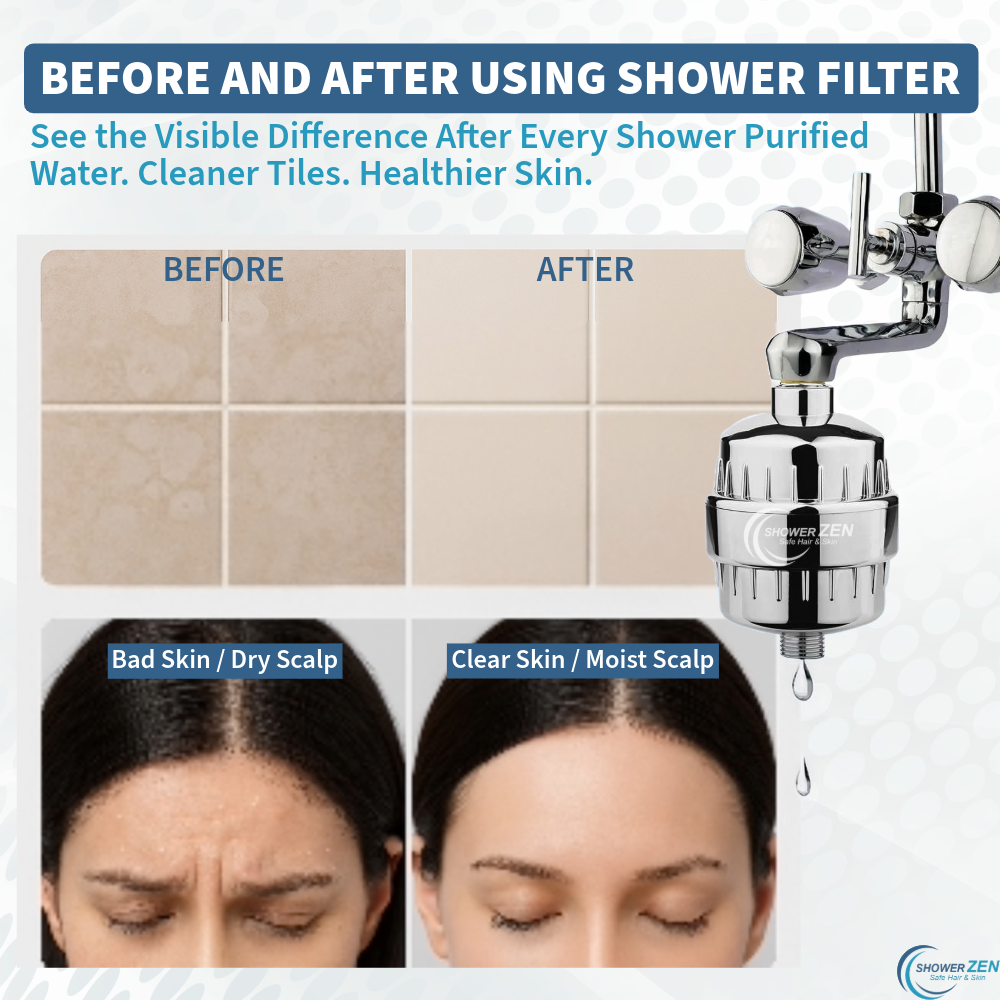 Shower Zen - Shower and Tap Filter